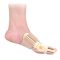 REHAB Bütyök korrigáló sín (1 pár) - Hallux valgus